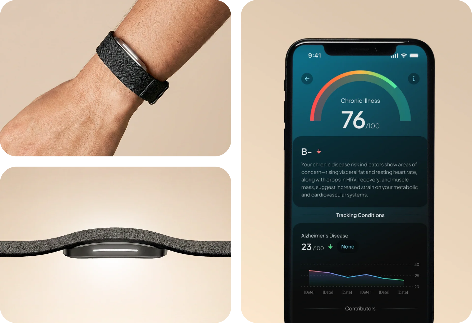 Collage showing a hume band 2.0 worn on a wrist, a side profile of the device, and a smartphone displaying a chronic illness risk dashboard with a score of 76/100 and health trend insights.